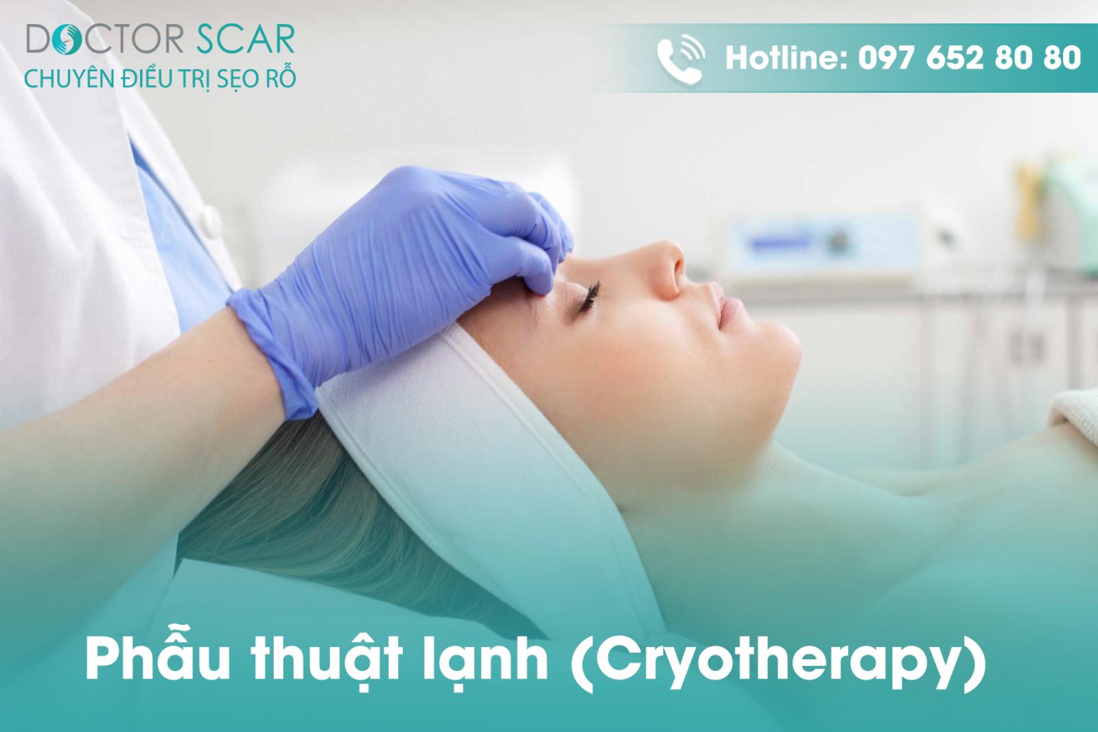 Phẫu thuật lạnh (Cryotherapy)