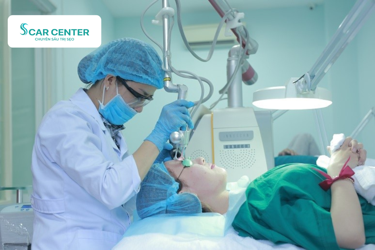Fractional CO2 trị sẹo rỗ vùng trán