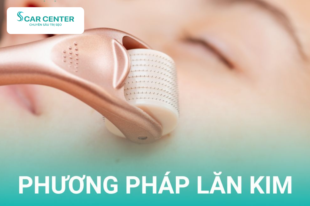 Lăn kim là gì?