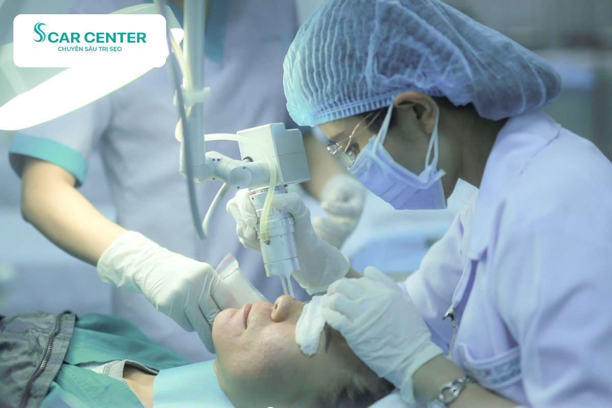 Laser Fractional CO₂ trị sẹo lõm trên má giúp tăng sinh collagen