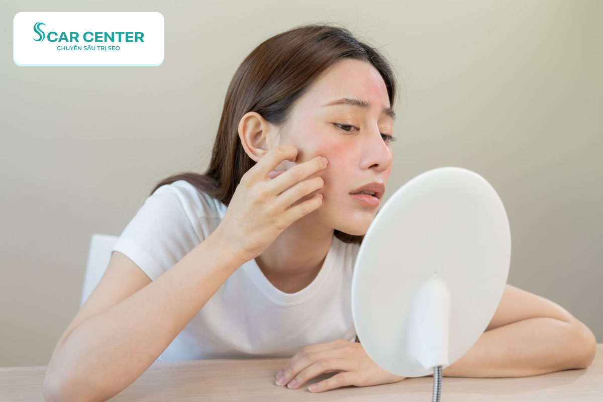 Như thế nào là da nhạy cảm?