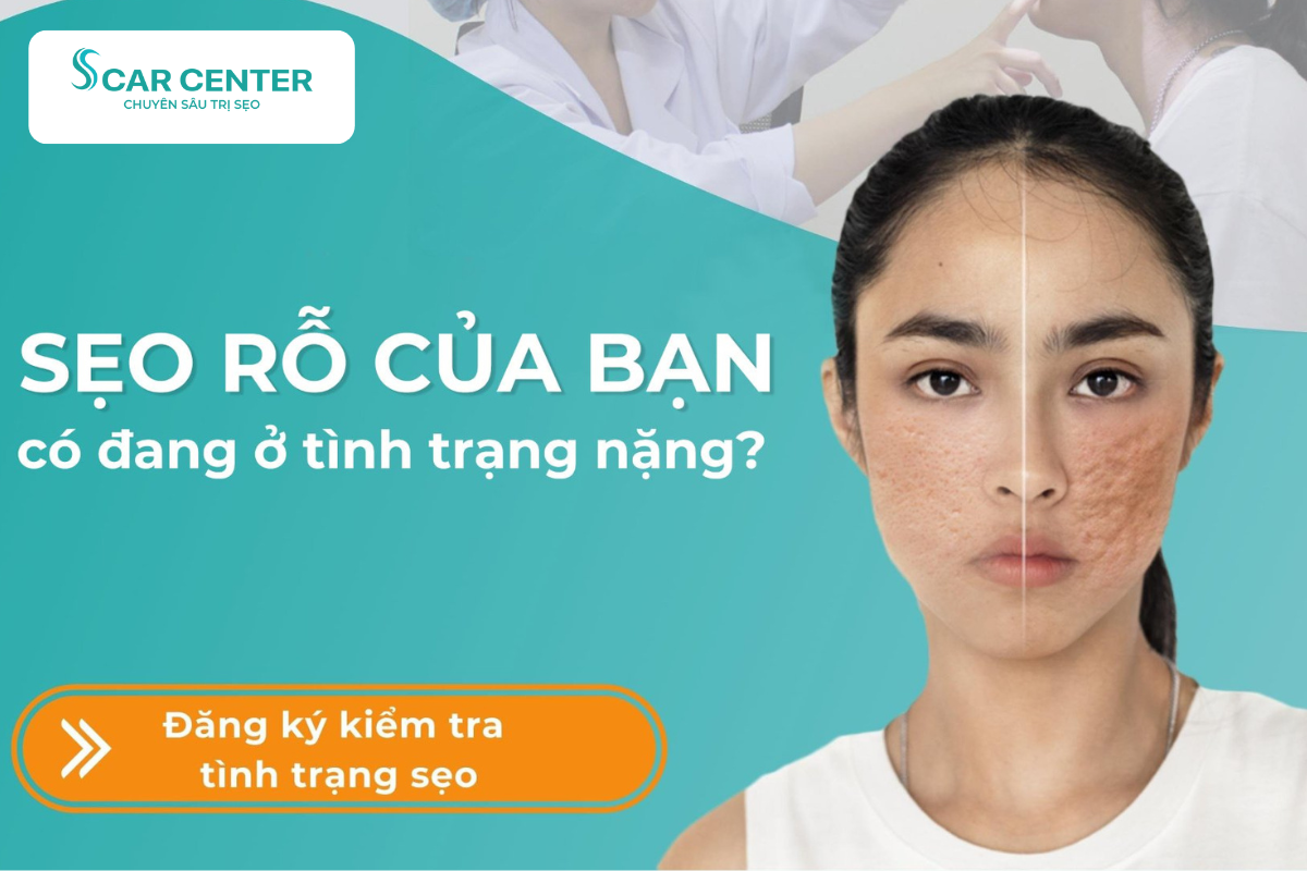 Tạm biệt sẹo lõm lâu năm 