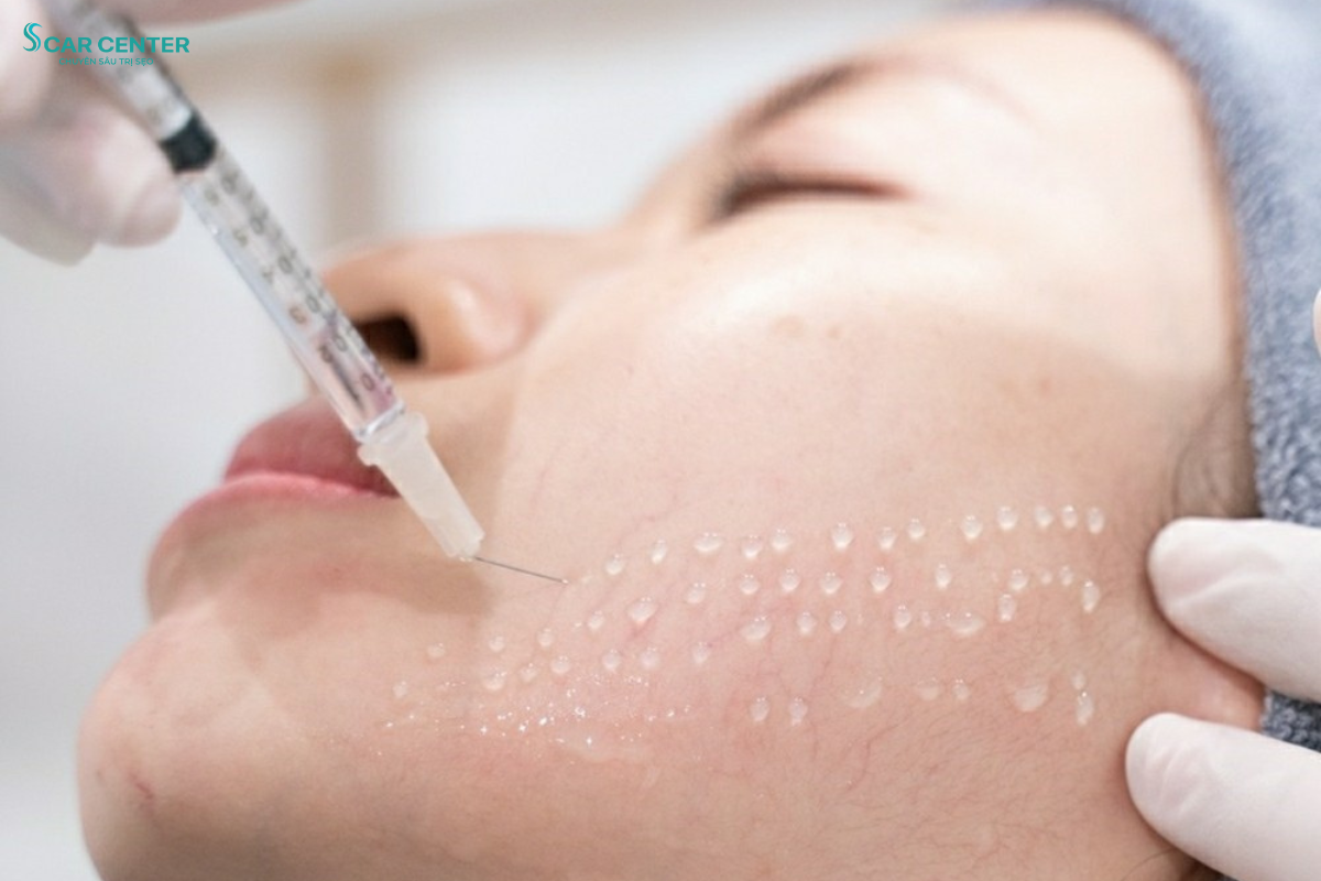 giảm nhờn - thu nhỏ lỗ chân lông