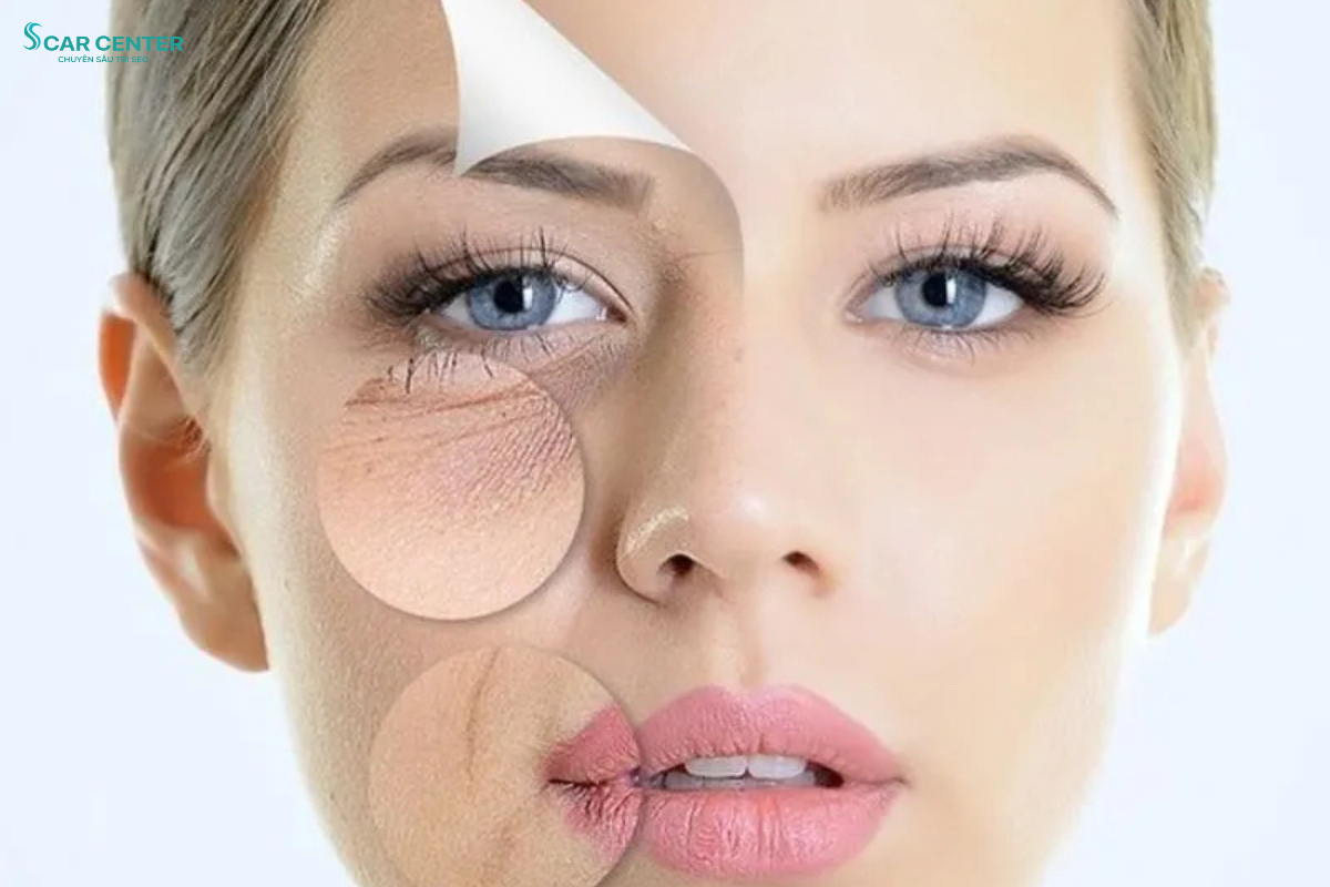 Trị liệu da đa tầng